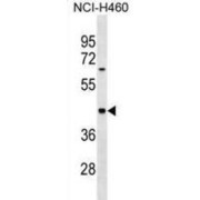 Myosin-Binding Protein H (MYBPH) Antibody