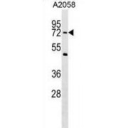 PHD Finger Protein 19 (PHF19) Antibody