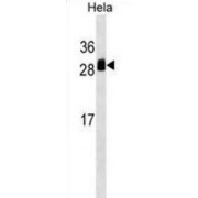 Transmembrane Emp24-Domain Containing Protein 1 (TMED1) Antibody
