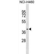 Postacrosomal Sheath WW Domain-Binding Protein (WBP2NL) Antibody