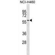 UDP-Glucuronosyltransferase 2A3 (UGT2A3) Antibody