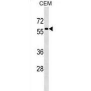 Male-Specific Lethal 3 Homolog (Drosophila) (MSL3) Antibody