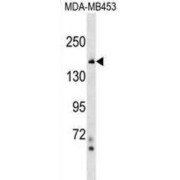 NF-Kappa-B Inhibitor-Like Protein 2 (NFKBIL2) Antibody