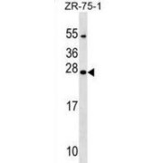 Nucleoredoxin-Like Protein 1 (NXNL1) Antibody