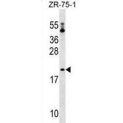 Probable Peptidyl-tRNA Hydrolase (PTRH1) Antibody