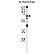 Vacuolar Fusion Protein MON1 Homolog B (MON1B) Antibody