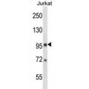 U2 SnRNP Associated SURP Domain Containing / SR140 (U2SURP) Antibody