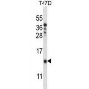 Coiled-Coil-Helix-Coiled-Coil-Helix Domain-Containing Protein 8 (CHCH8) Antibody