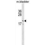 Platelet Glycoprotein IX (GP9) Antibody