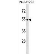 V-Type Proton ATPase Subunit C 2 (ATP6V1C2) Antibody