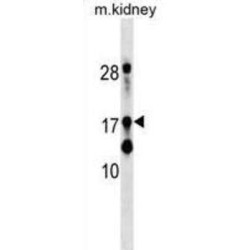 Down Regulator Of Transcription 1, TBP Binding (DR1) Antibody