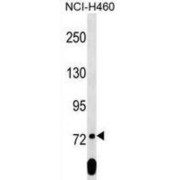 Sex Comb On Midleg Like 2 (Drosophila) (SCML2) Antibody