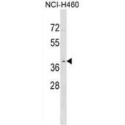 Olfactory Receptor Family 2 Subfamily Y Member 1 (OR2Y1) Antibody