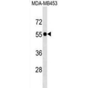 Selenocysteine Lyase (SCLY) Antibody