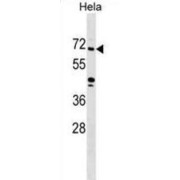 Zinc Finger Protein 280B (ZNF280B) Antibody