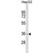 Dehydrogenase/Reductase SDR Family Member 1 (DHRS1) Antibody