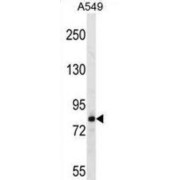 Fibrous Sheath CABYR Binding Protein (FSCB) Antibody