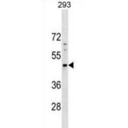 Paraneoplastic Antigen-Like Protein 5 (PNMA5) Antibody