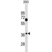 Complement C1q Tumor Necrosis Factor-Related Protein 7 (C1QTNF7) Antibody