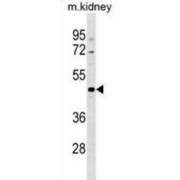 Coiled-Coil Domain Containing 91 (CCDC91) Antibody