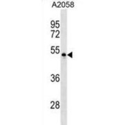 Poliovirus Receptor Related Protein 4 (PVRL4) Antibody