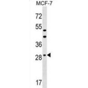 Dehydrogenase/Reductase SDR Family Member 11 (DHRS11) Antibody