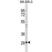 Zinc Finger Protein 688 (ZNF688) Antibody