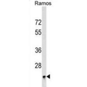 BRI3-Binding Protein (BRI3BP) Antibody