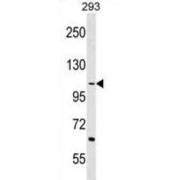 Testis-Expressed Protein 2 (TEX2) Antibody