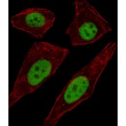 Transcription Factor AP-2-Delta (TFAP2D) Antibody