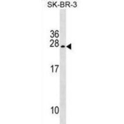 Tumor Suppressor Candidate 5 (TUSC5) Antibody