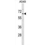 Zinc Finger Protein 675 (ZNF675) Antibody