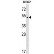 Acid-Sensing Ion Channel 5 (ACCN5) Antibody