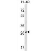 Cell Growth Regulator With EF-Hand Domain 1 (CGREF1) Antibody