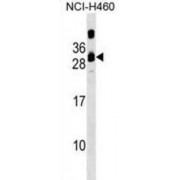 Calcium And Integrin Binding Family Member 3 (CIB3) Antibody