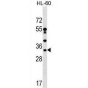 DnaJ Heat Shock Protein Family (Hsp40) Member C17 (DNAJC17) Antibody