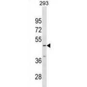 Inositol Hexakisphosphate Kinase 3 (IP6K3) Antibody