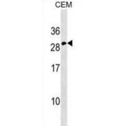 Erythropoietin (EPO) Antibody