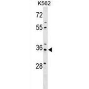 PDZ And LIM Domain 4 (PDLIM4) Antibody
