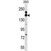 Fanconi Anemia Group A Protein (FANCA) Antibody