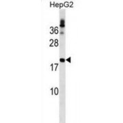 WB analysis of HepG2 cell line lysates (35 µg/lane), using LHFP Antibody.
