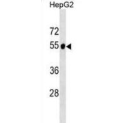 Alanine Aminotransferase 2 (GPT2) Antibody