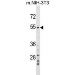 Alanine Aminotransferase 2 (GPT2) Antibody