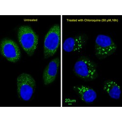 Microtubule-Associated Proteins 1A/1B Light Chain 3A (MAP1LC3A) Antibody