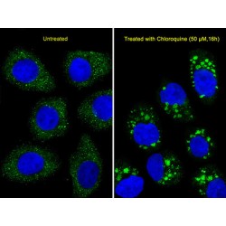 Microtubule-Associated Proteins 1A/1B Light Chain 3A (MAP1LC3A) Antibody