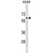 Translocating Chain-Associated Membrane Protein 1-Like 1 (TRAM1L1) Antibody