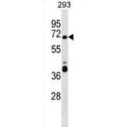 Zinc Finger Protein 79 (ZNF79) Antibody