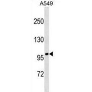 FANCB Antibody