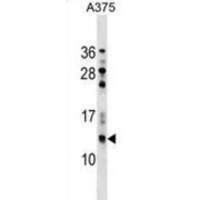 Nerve Growth Factor Receptor-Associated Protein 1 (NGFRAP1) Antibody