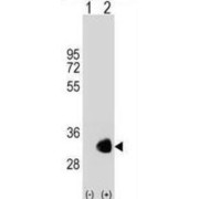 Glycine N-Methyltransferase (GNMT) Antibody